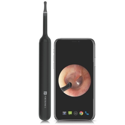 Portronics Xlife Smart Wireless Ear Otoscope Cleaner with 6 LED Lights,Control Via App (Black)